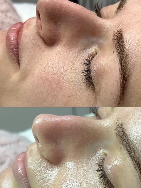 Tratament de curatare in profunzime made by Noemi Vincze - from Stailer