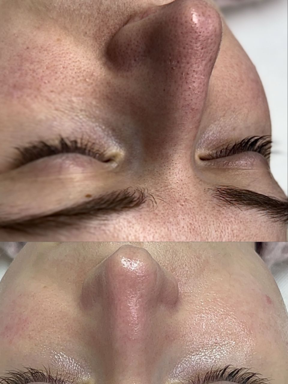 Tratament de curatare in profunzime made by Noemi Vincze - from Stailer Tratament de curatare in profunzime made by Noemi Vincze - from Stailer