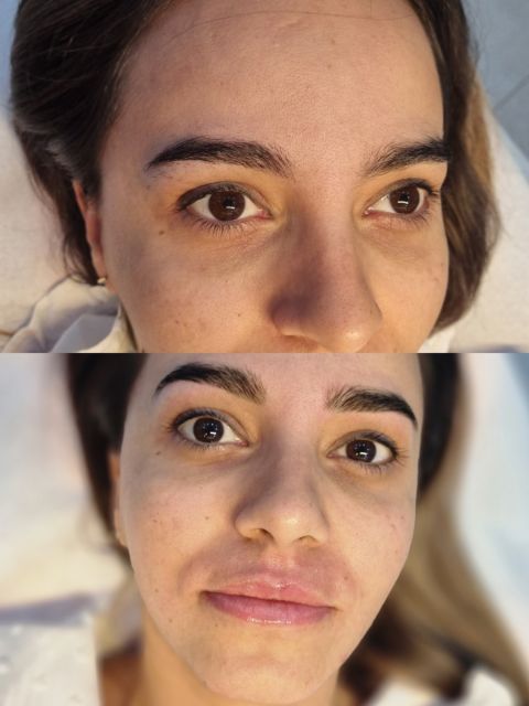 Tratament facial - curatare clasica