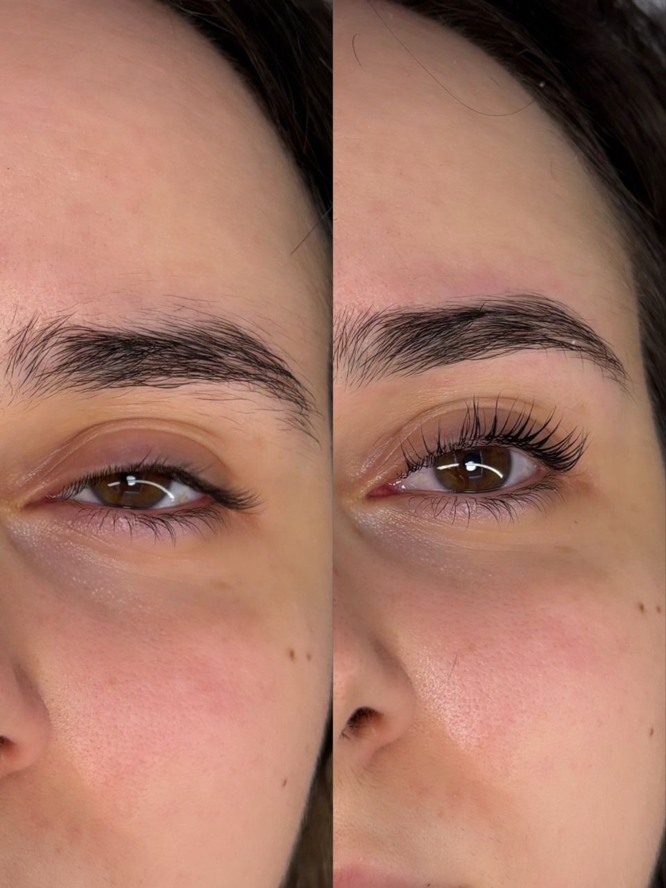 Laminare gene made by Szilvia Szanto - from Stailer