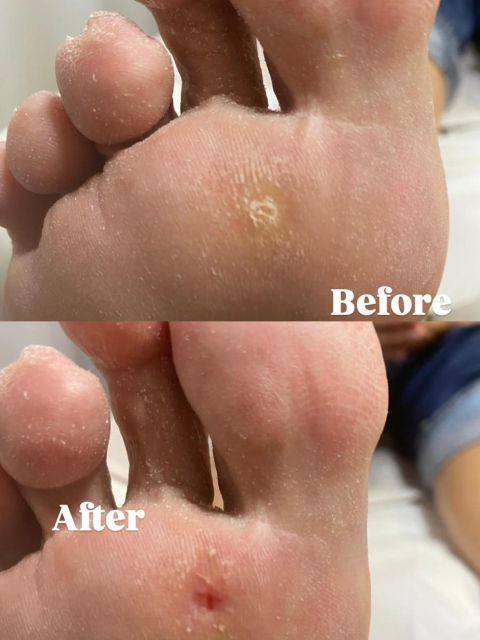 Pedichiura medicala made by Georgeta Lucan - from Stailer