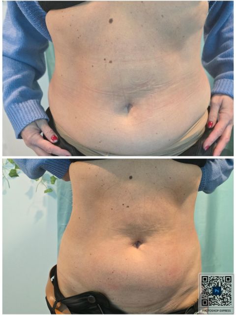 VelaShape 1 made by Denisa  Rarau  - from Stailer