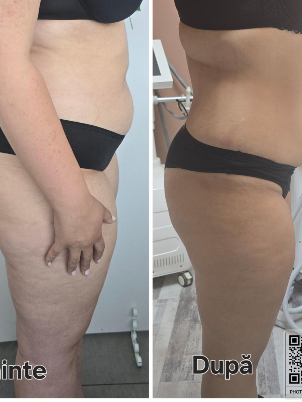 VelaShape 1 made by Denisa  Rarau  - from Stailer
