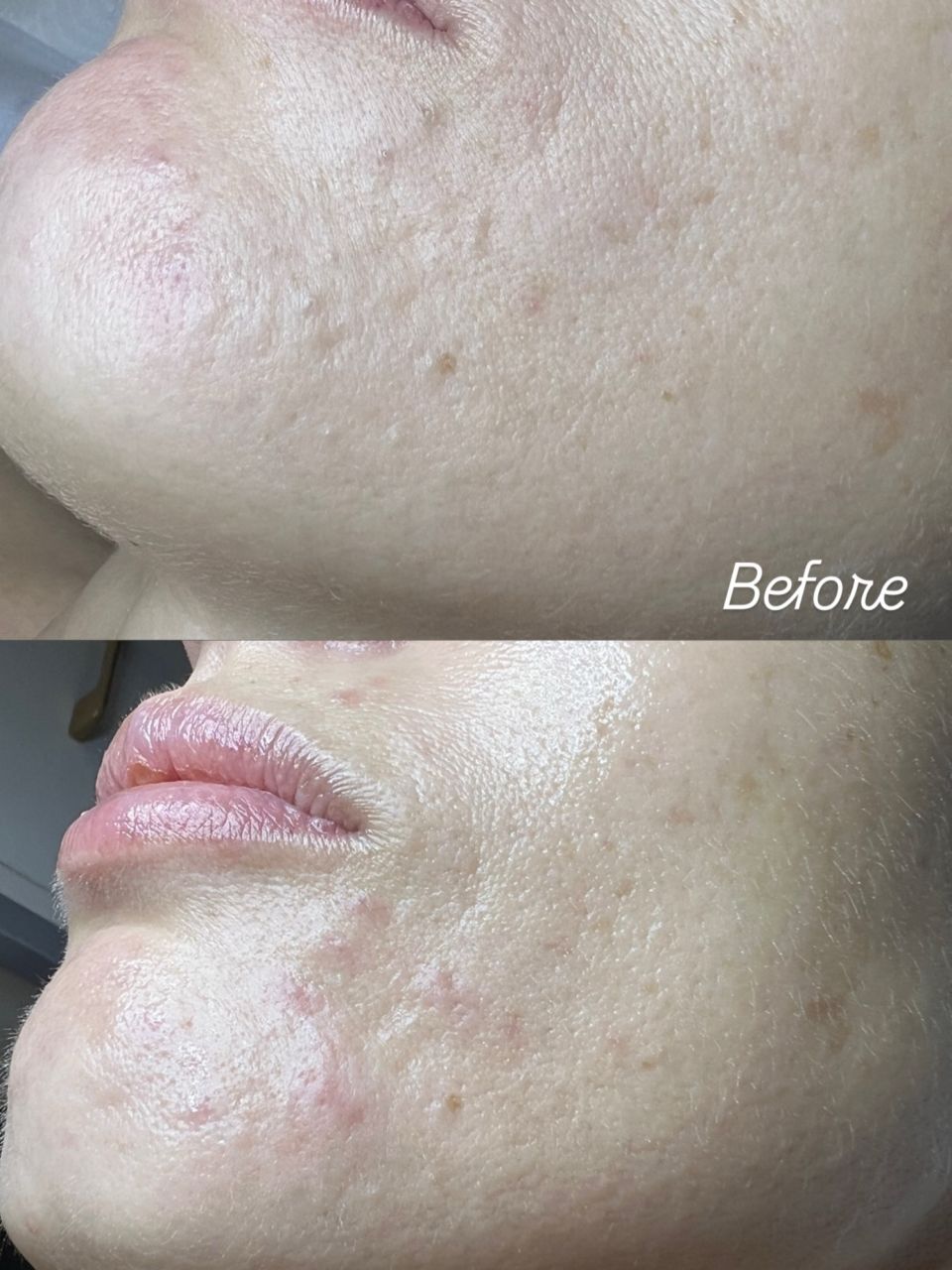 Tratament facial - Curatare made by Mariana   - from Stailer