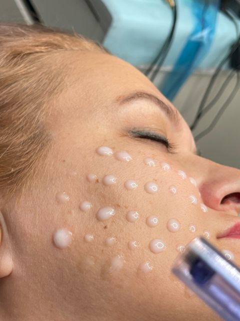 Mezoterapie cu cocktailuri vitaminice made by Maria  Vieru - from Stailer