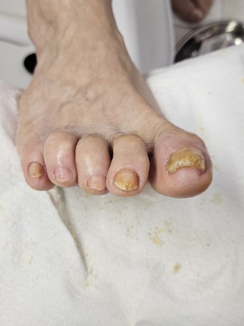 Pedichiura clasica complexa made by Anita Gandtner - from Stailer