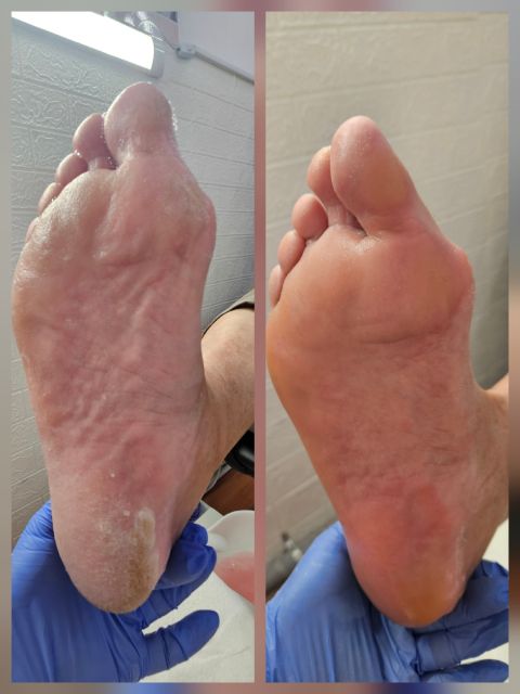 Pedichiura clasica simpla made by Anita Gandtner - from Stailer