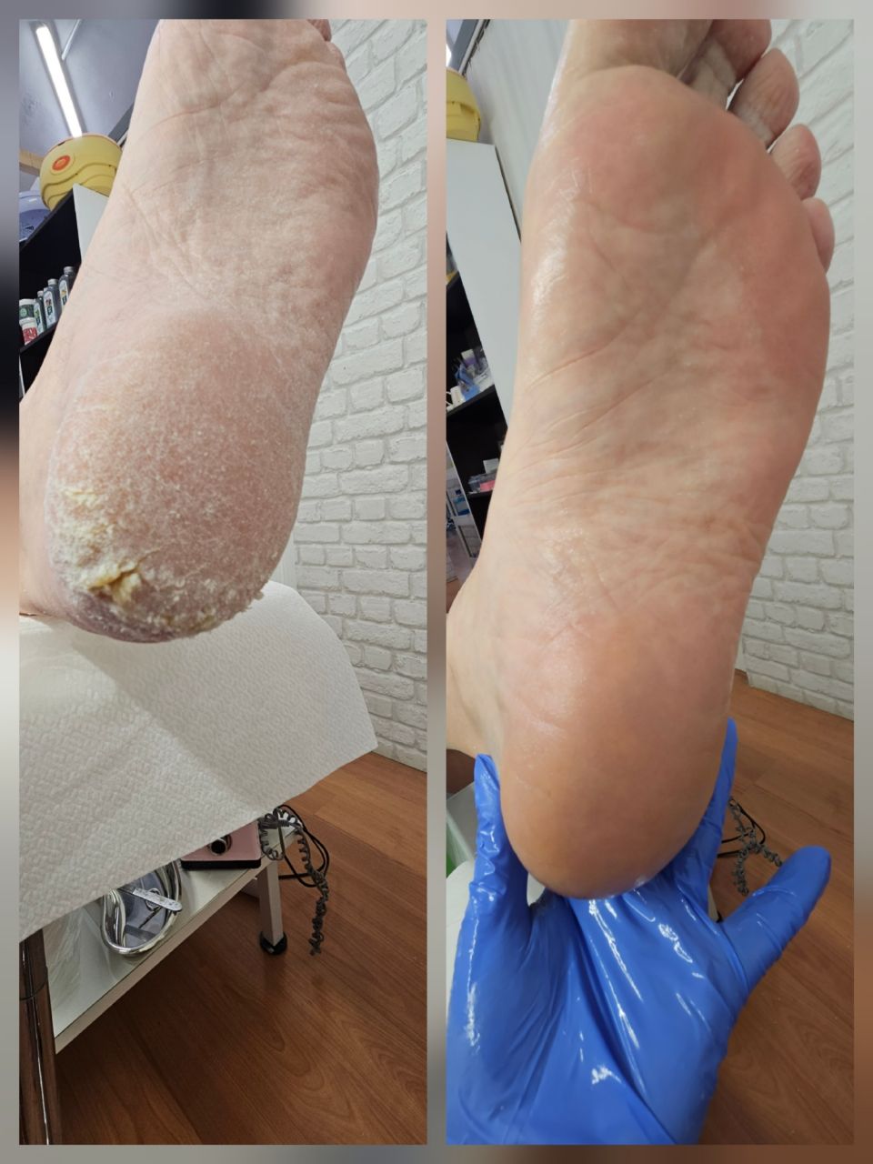 Pedichiura clasica simpla made by Anita Gandtner - from Stailer