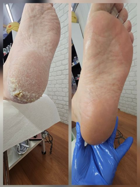 Pedichiura clasica simpla made by Anita Gandtner - from Stailer