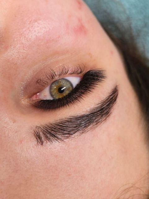 Extensii gene - curbura M