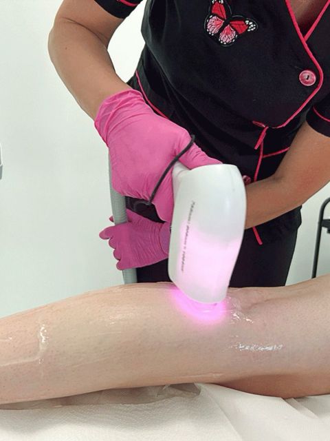 Epilare definitiva -  zona medie made by Nicoleta Ana Pohl - from Stailer