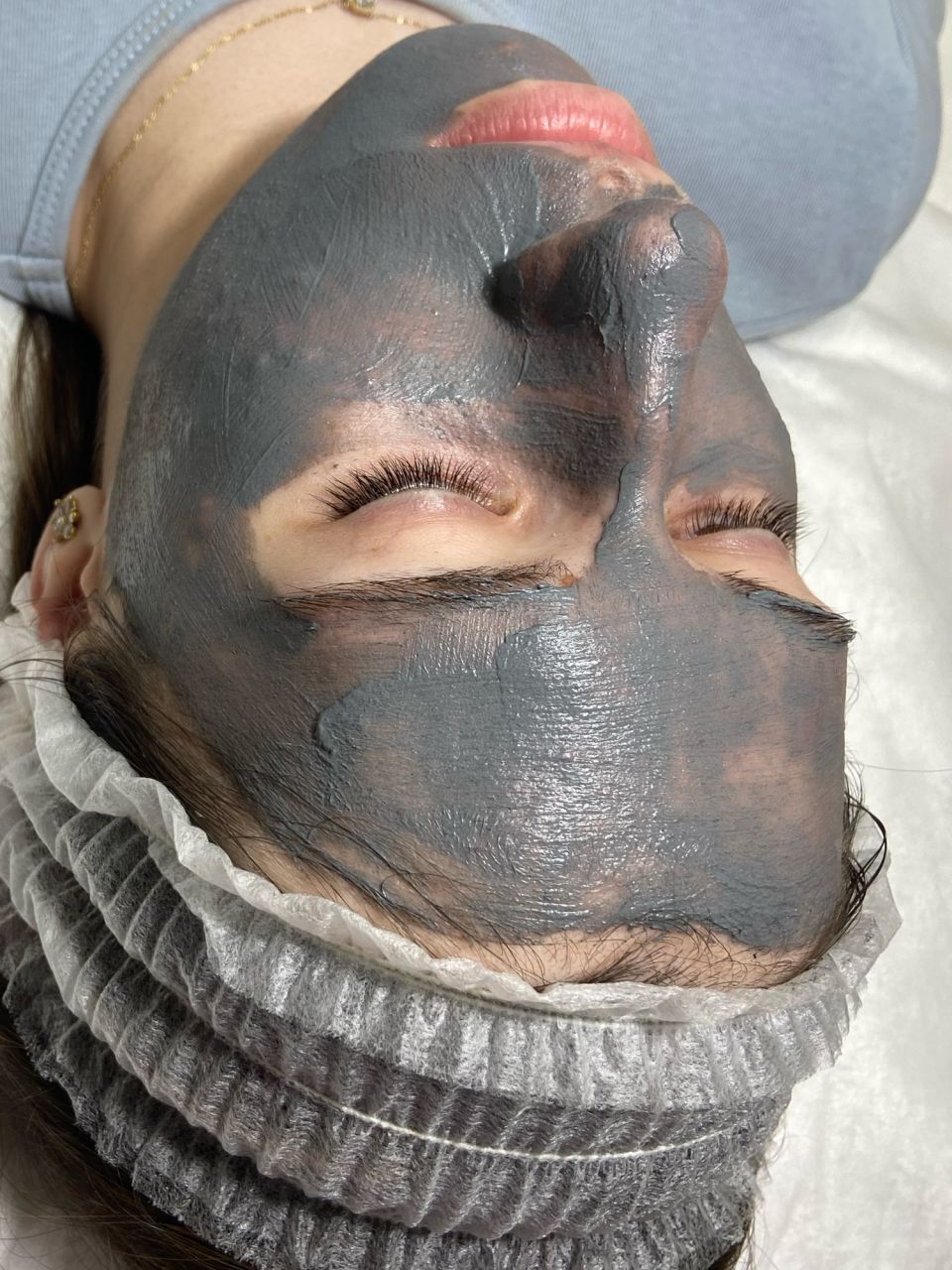 Tratament facial - 3D Curatare intensa  a tenului acneic made by Lidia Zaporojan - from Stailer