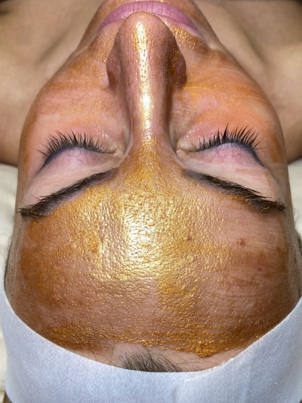 Tratament facial - Carboxi Terapie 3D Lifting made by Lidia Zaporojan - from Stailer