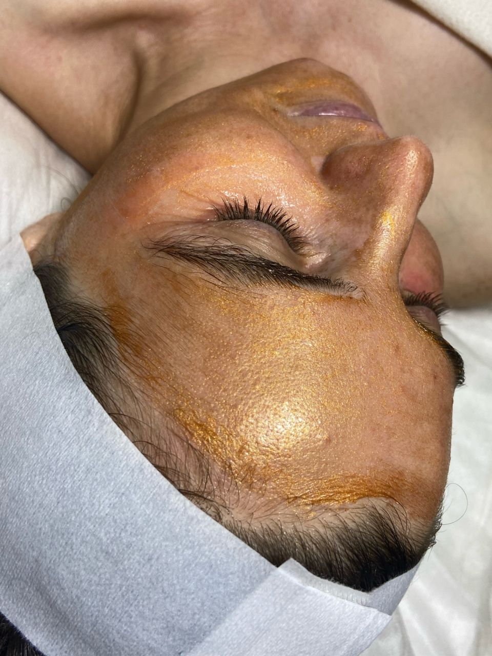 Tratament facial - Carboxi Terapie 3D Lifting made by Lidia Zaporojan - from Stailer
