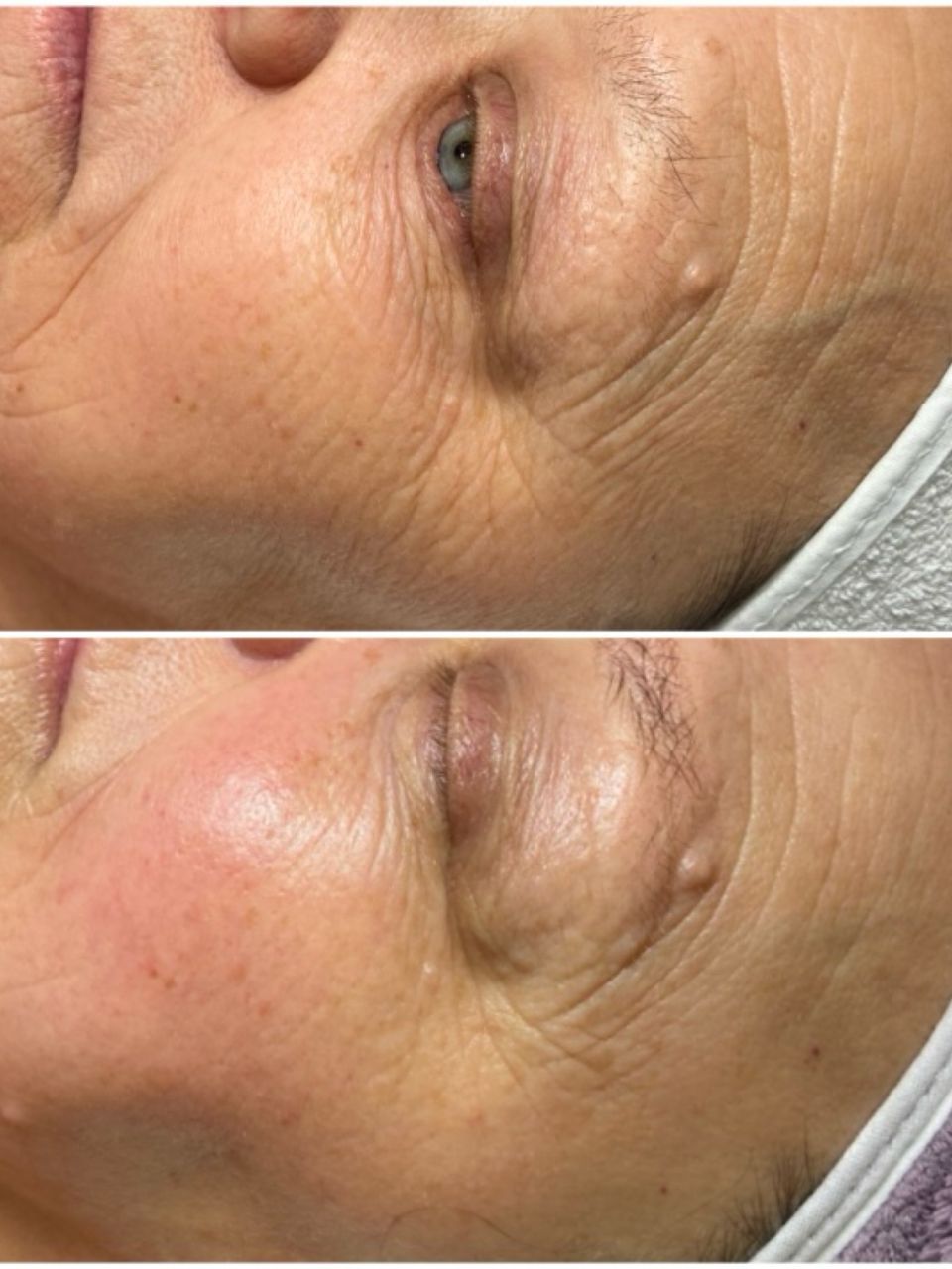 Tratament facial - lift intens peeling cu masaj facial made by Lidia Zaporojan - from Stailer