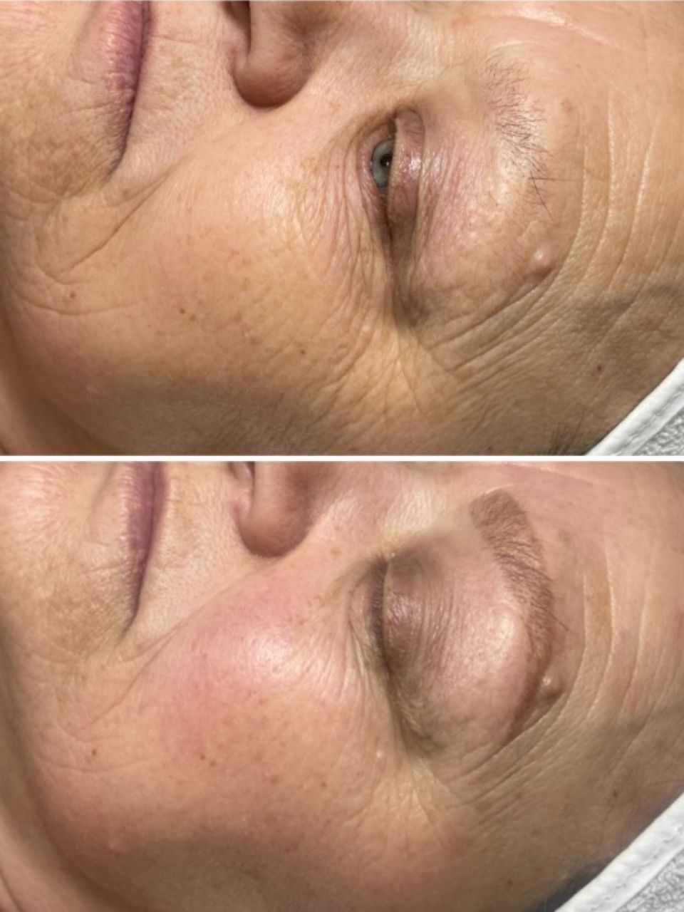 Tratament facial - lift intens peeling cu masaj facial made by Lidia Zaporojan - from Stailer