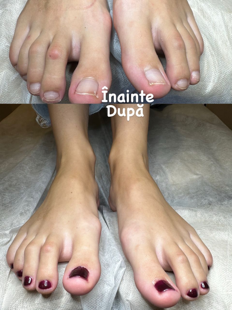 Pedichiura medicala si Oja semipermanenta made by Alexandrina Mitul - from Stailer Pedichiura medicala si Oja semipermanenta made by Alexandrina Mitul - from Stailer