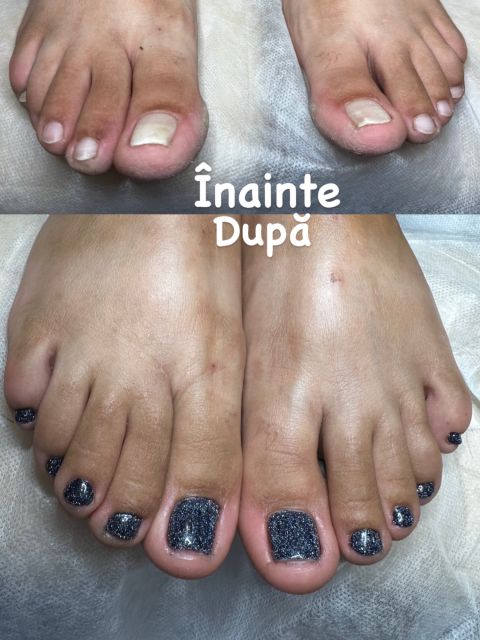 Pedichiura medicala si Oja semipermanenta made by Alexandrina Mitul - from Stailer