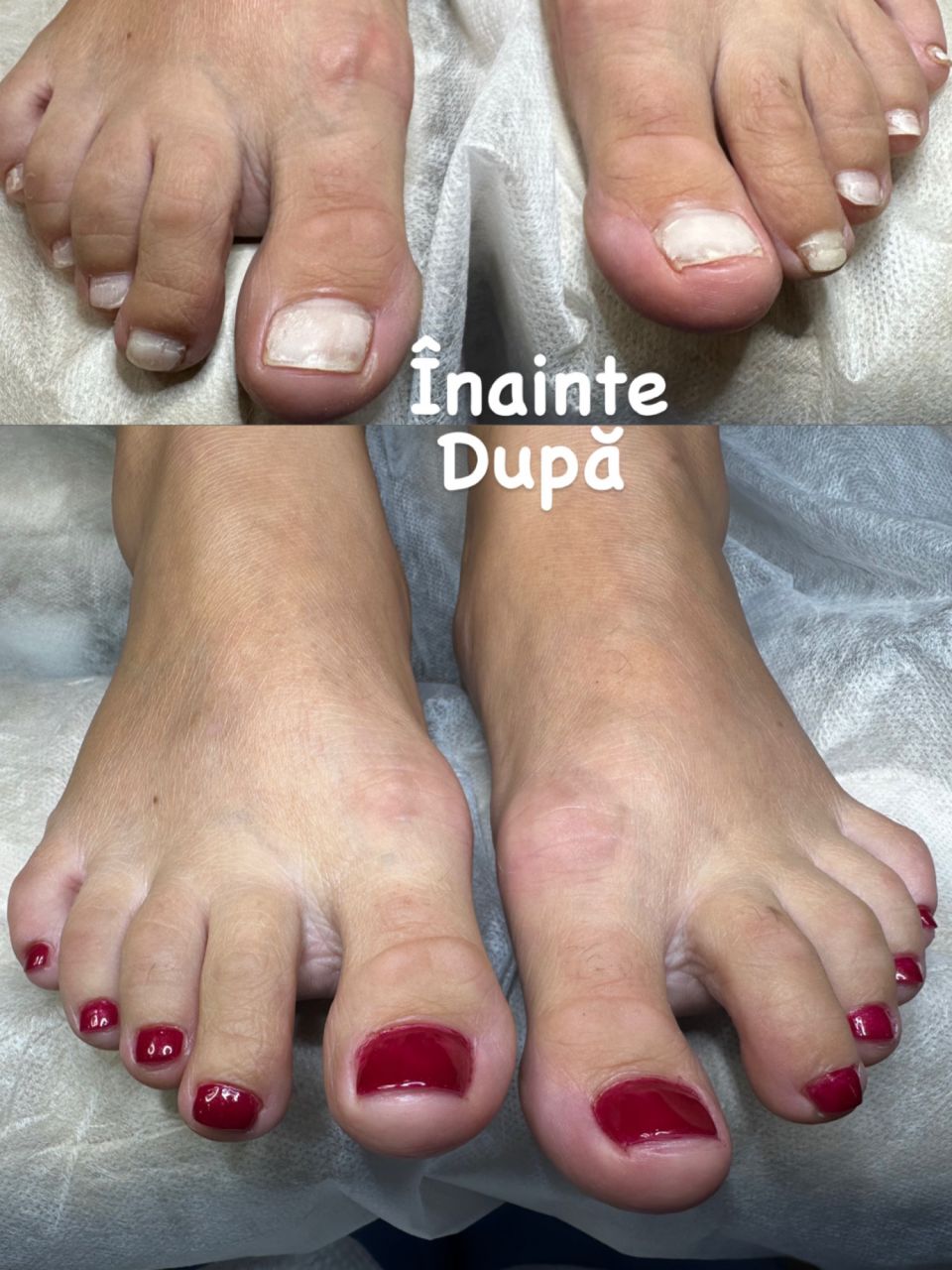 Pedichiura medicala si Oja semipermanenta made by Alexandrina Mitul - from Stailer Pedichiura medicala si Oja semipermanenta made by Alexandrina Mitul - from Stailer