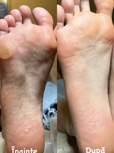 Pedichiura medicala si Oja semipermanenta made by Alexandrina Mitul - from Stailer