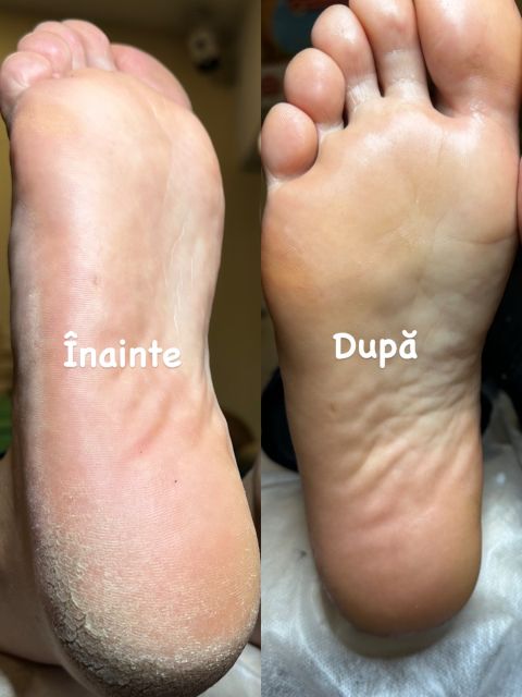 Pedichiura medicala si Oja semipermanenta made by Alexandrina Mitul - from Stailer