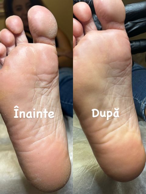 Pedichiura medicala si Oja semipermanenta made by Alexandrina Mitul - from Stailer