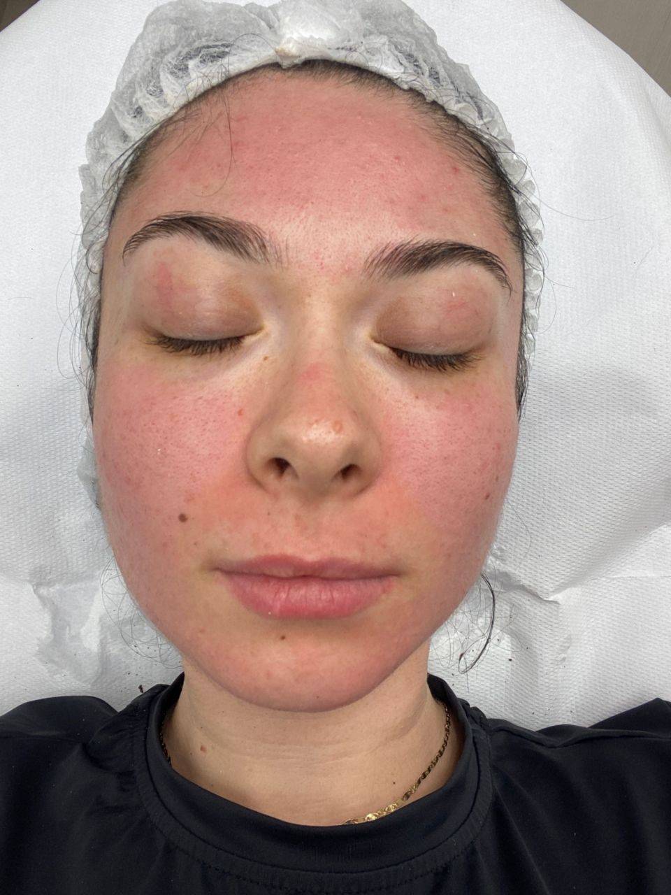 Tratament facial - Acnee made by Mihaela Apetroaei - from Stailer