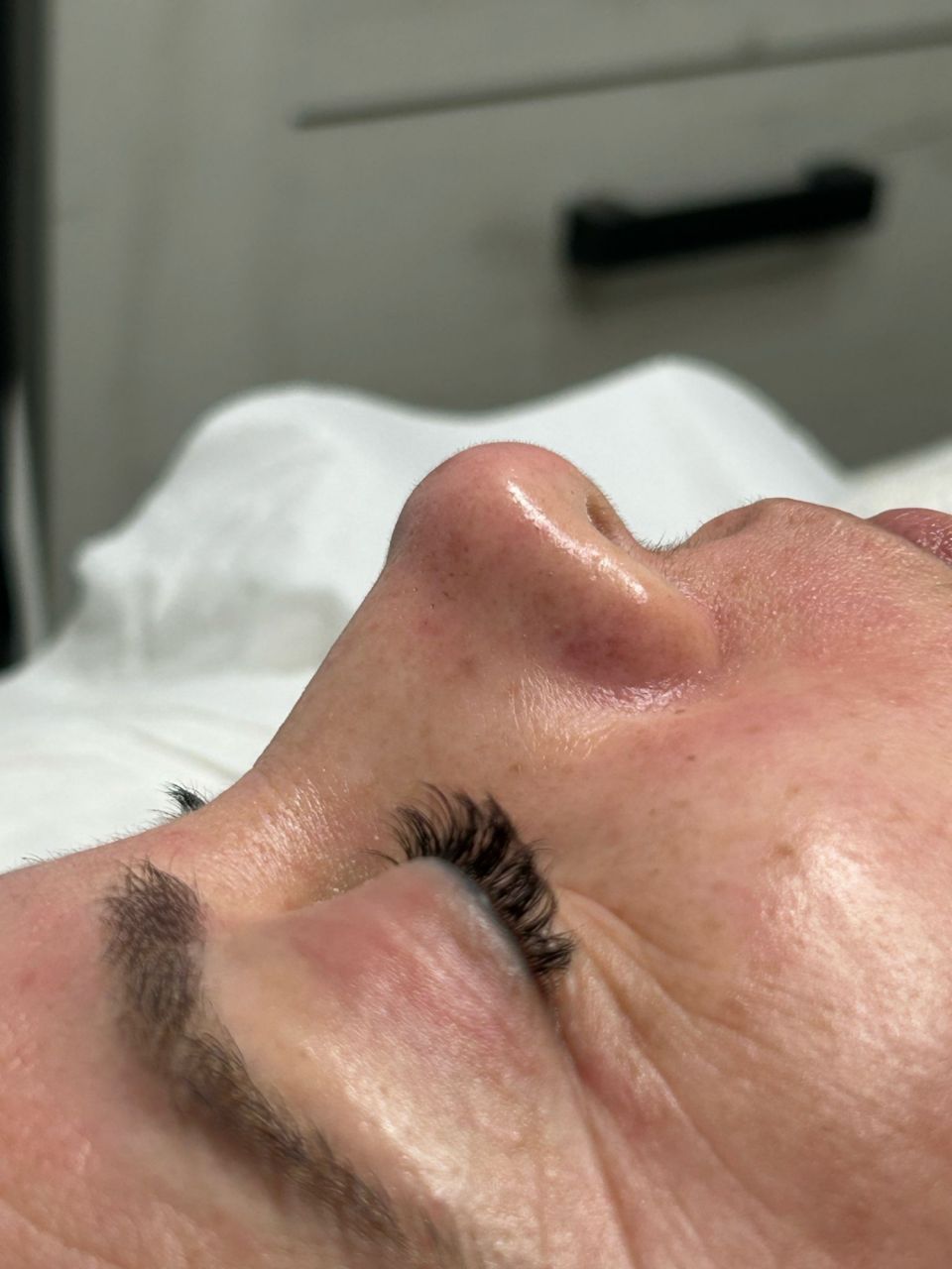 Tratament Peeling Dermedics made by Ana Maria Tanase - from Stailer