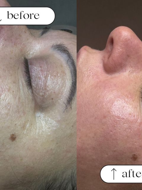 Tratament facial - Curatare si Hidratare