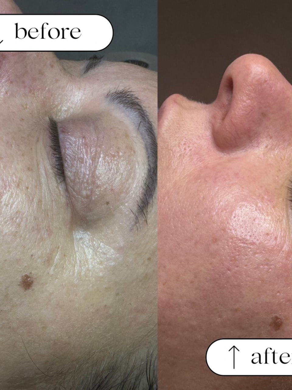 Tratament facial - Curatare si Hidratare made by Catalina Harip - from Stailer Tratament facial - Curatare si Hidratare made by Catalina Harip - from Stailer