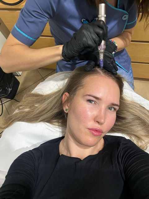 Microneedling made by Aida Ungureanu - from Stailer