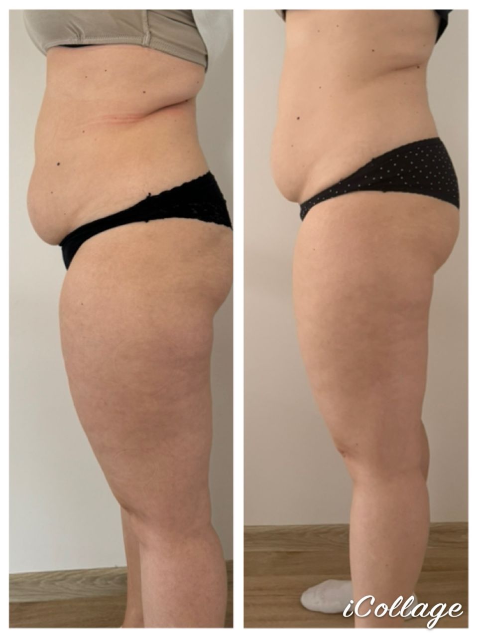 Viora V-FORM - Abdomen mare made by Dalia Lonca - from Stailer