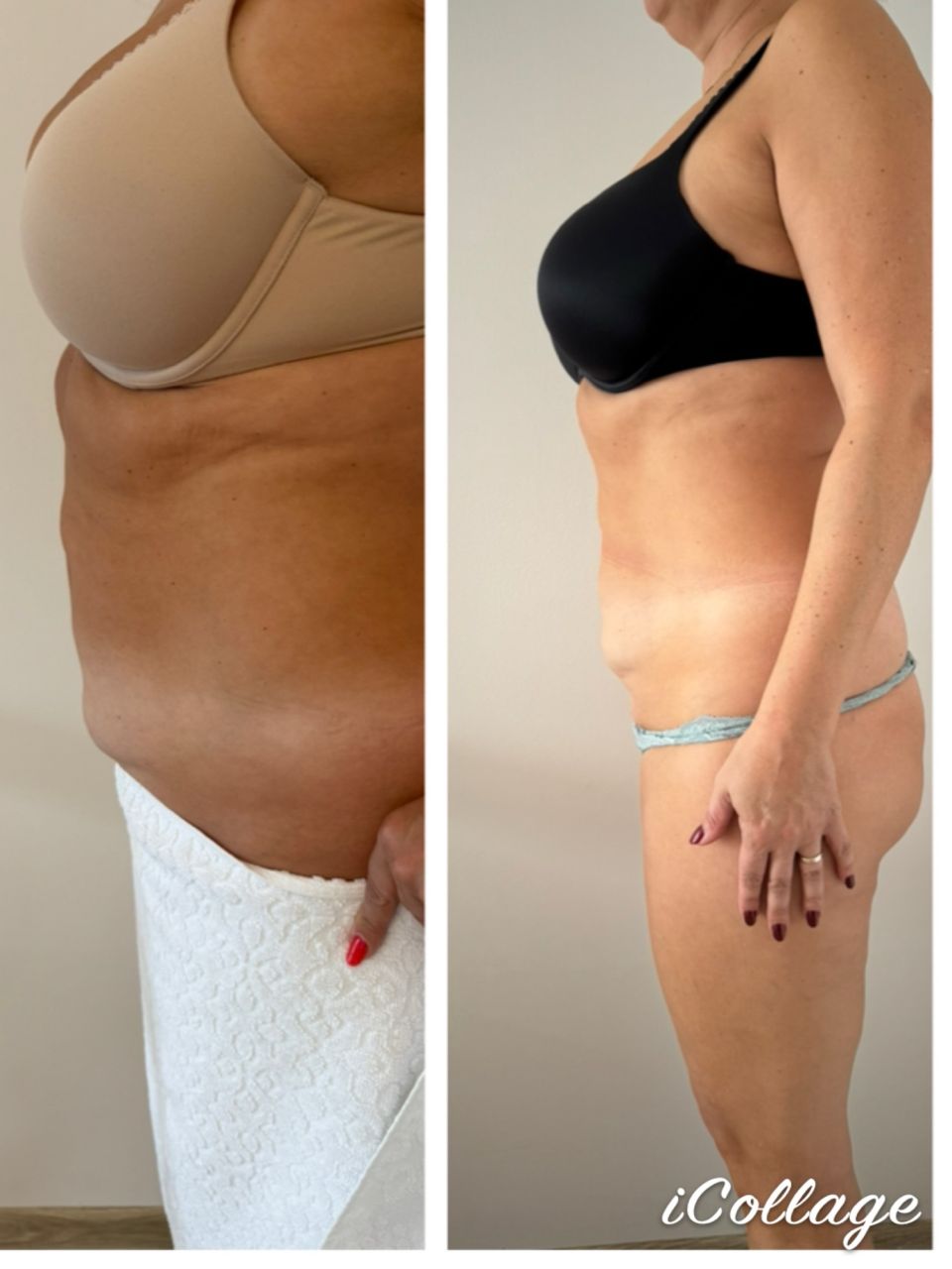 Viora V-FORM - Abdomen mare made by Dalia Lonca - from Stailer