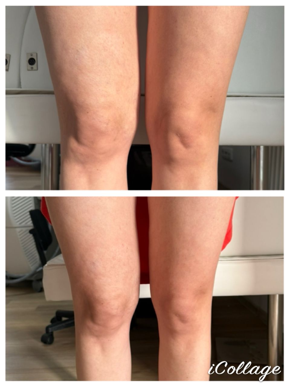 Viora V-FORM - Genunchi made by Dalia Lonca - from Stailer