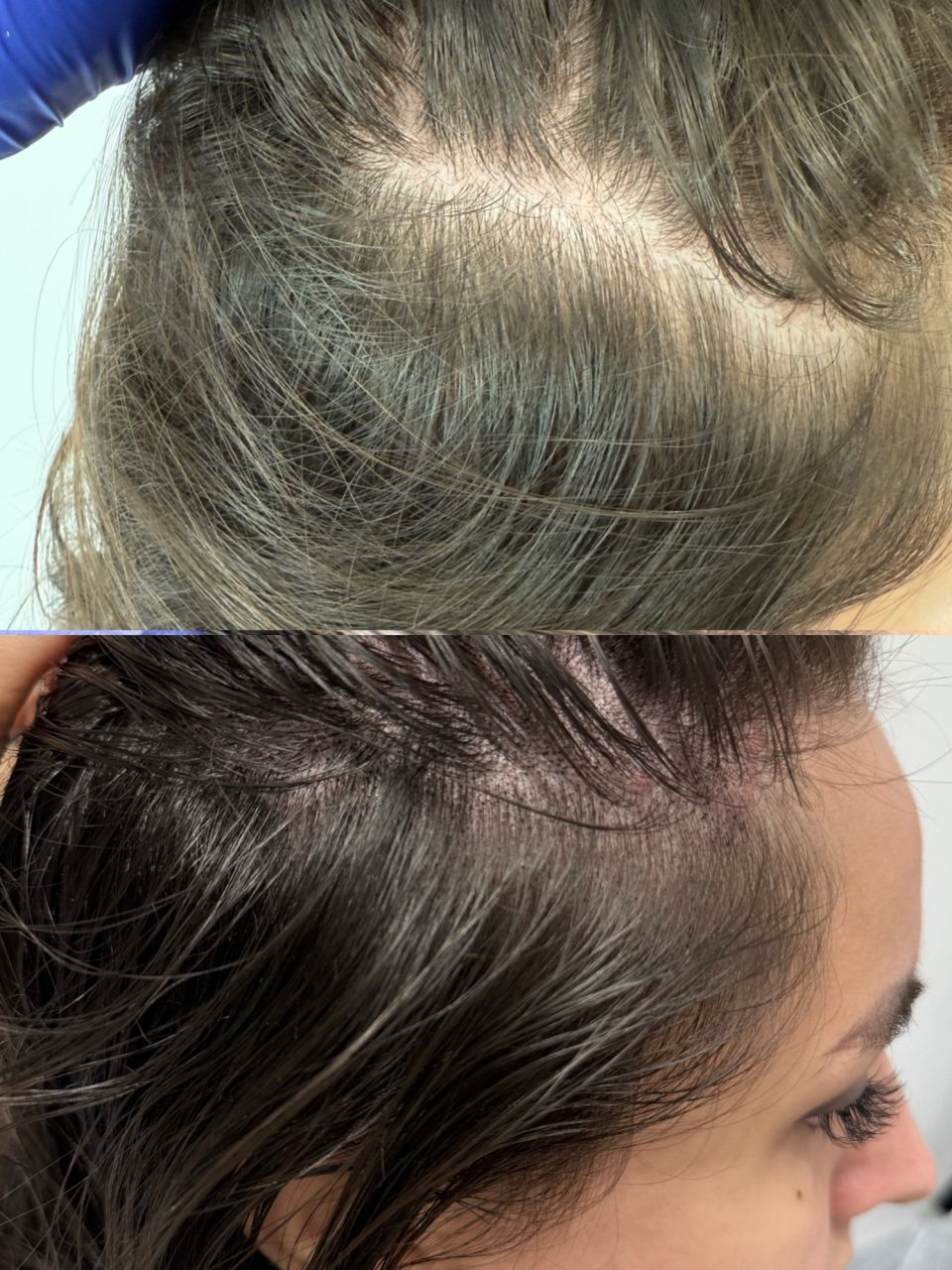 Tricopigmentare Scalp made by Alexandra Marcut - from Stailer
