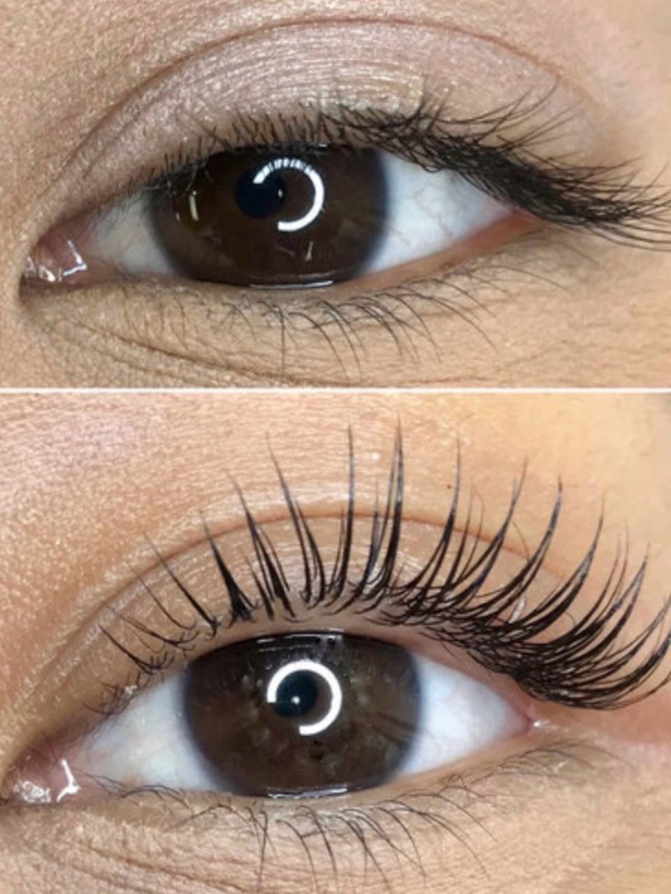 Laminare gene made by Alexandra Cocerjuc - from Stailer