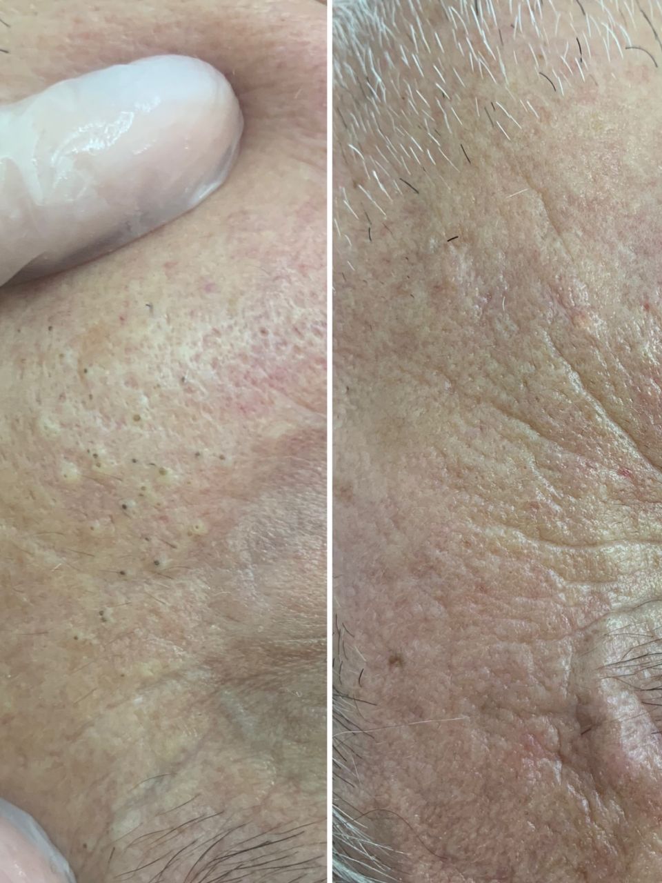 Tratament facial - Curatare made by Alexandra Cocerjuc - from Stailer