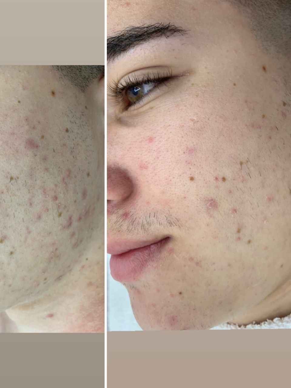 Tratament facial - Curatare made by Alexandra Cocerjuc - from Stailer