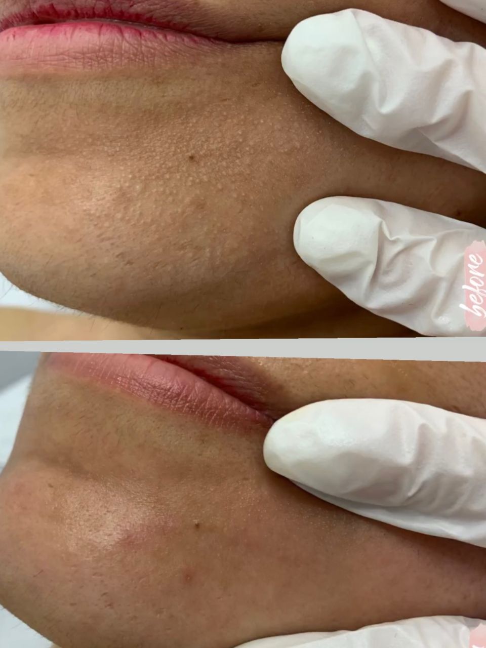 Tratament facial - Curatare made by Alexandra Cocerjuc - from Stailer