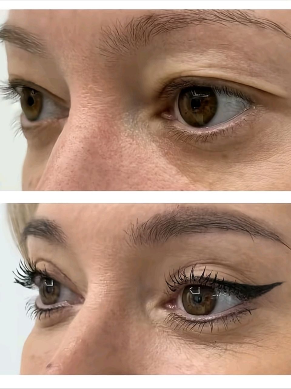 Blefaroplastie nechirurgicala made by Ioana Tuș - from Stailer