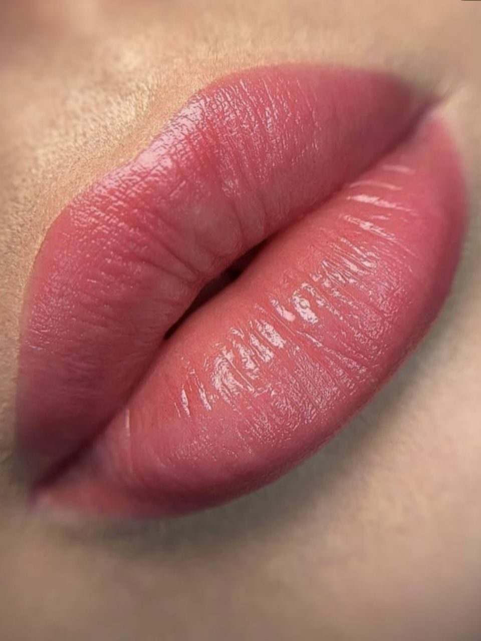 Marire buze cu acid hialuronic made by Ioana Tuș - from Stailer
