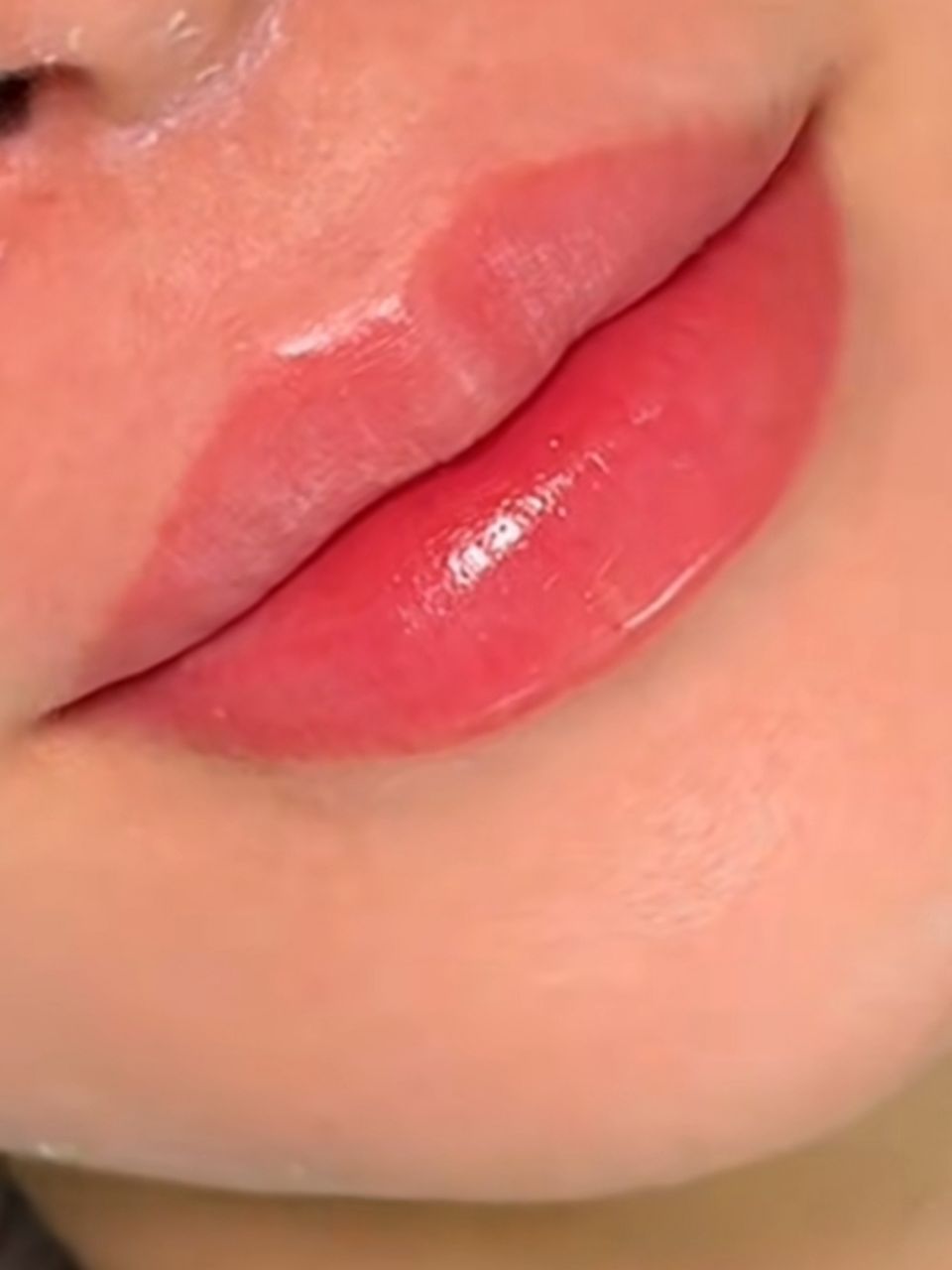 Marire buze cu acid hialuronic made by Ioana Tuș - from Stailer
