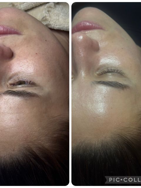 Peeling Chimic  made by Mihalea Alexandra  - from Stailer