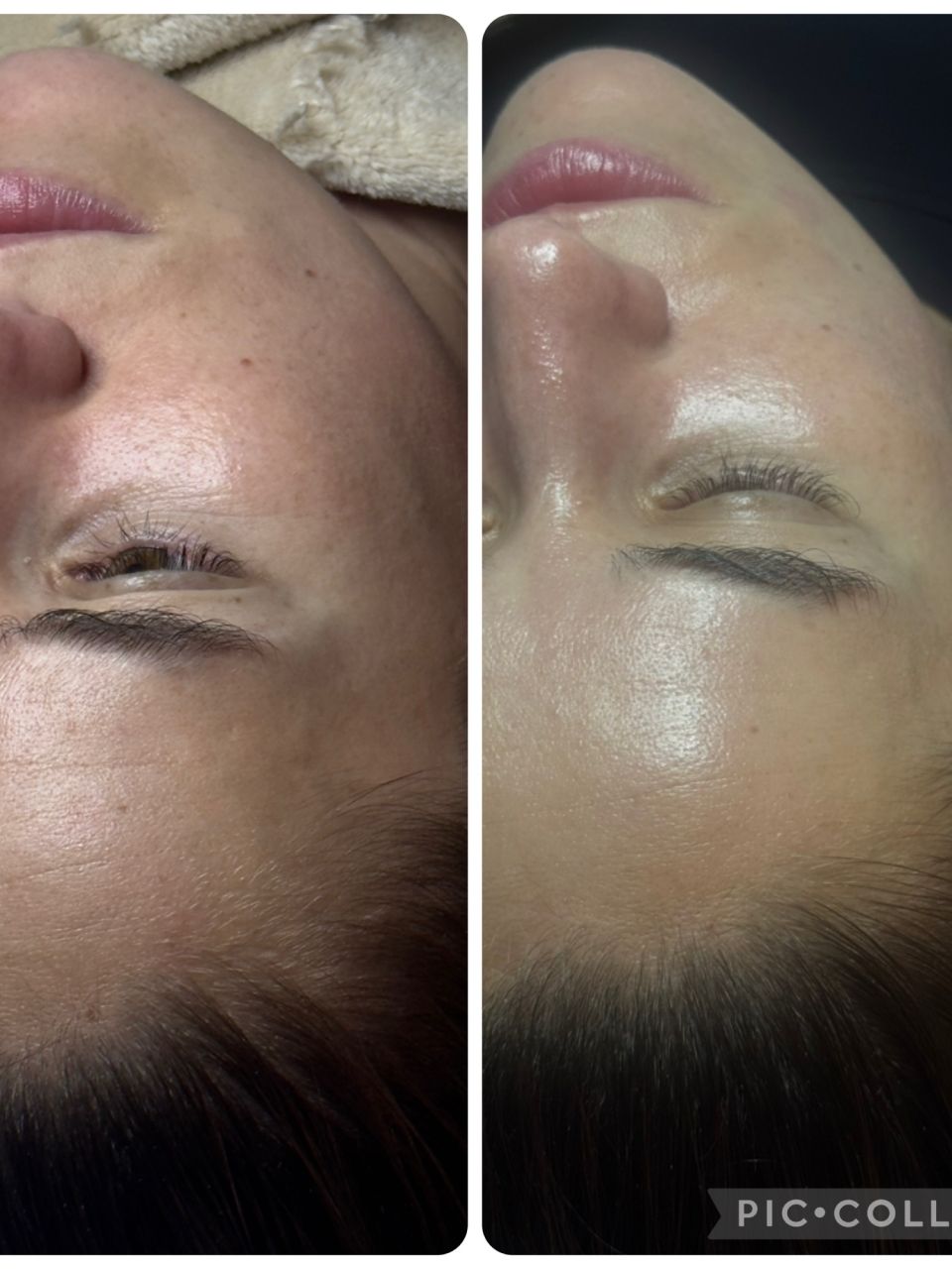 Peeling Chimic  made by Mihalea Alexandra  - from Stailer