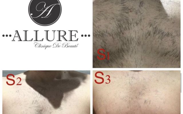 Allure Clinique de Beaute